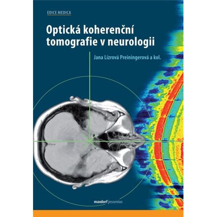 Optická koherenční tomografie v neurologii
