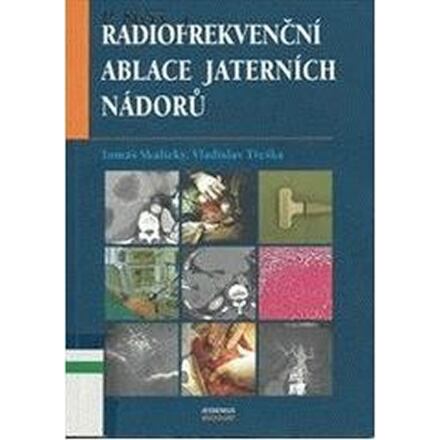 Radiofrekvenční ablace jaterních nádorů