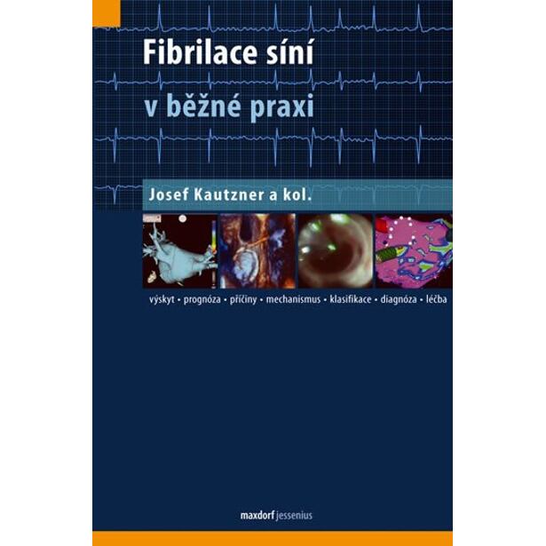 Fibrilace síní v běžné praxi